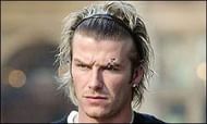 beckham eye stitches